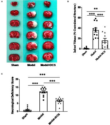 Neuroprotective Effects of Deproteinized Calf Serum in Ischemic Stroke